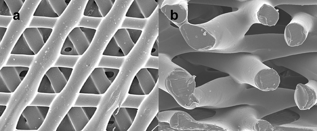 Honeycomb microstructure of Osteopore’s implant. Top view (left) and side view (right)