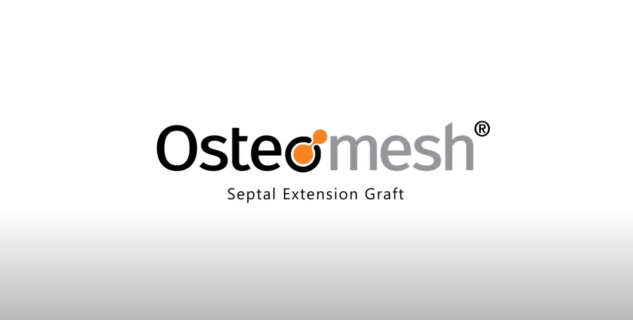 Extension Septal