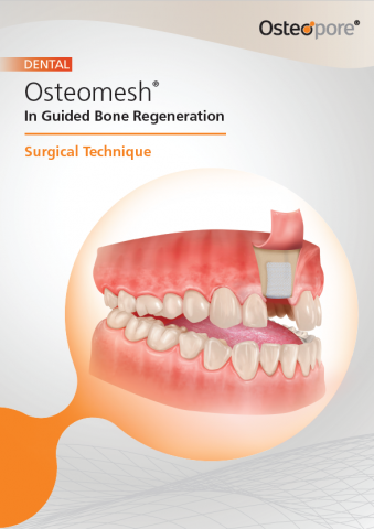 Guided bone regeneration