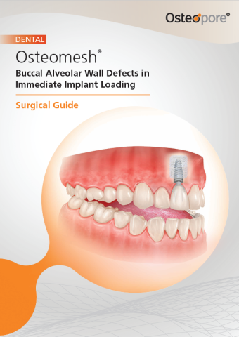 Free E-Surgical Guide: Osteomesh® in Immediate Implant Loading