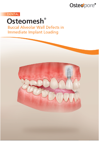 Brochure: Osteomesh® in Immediate Implant Loading