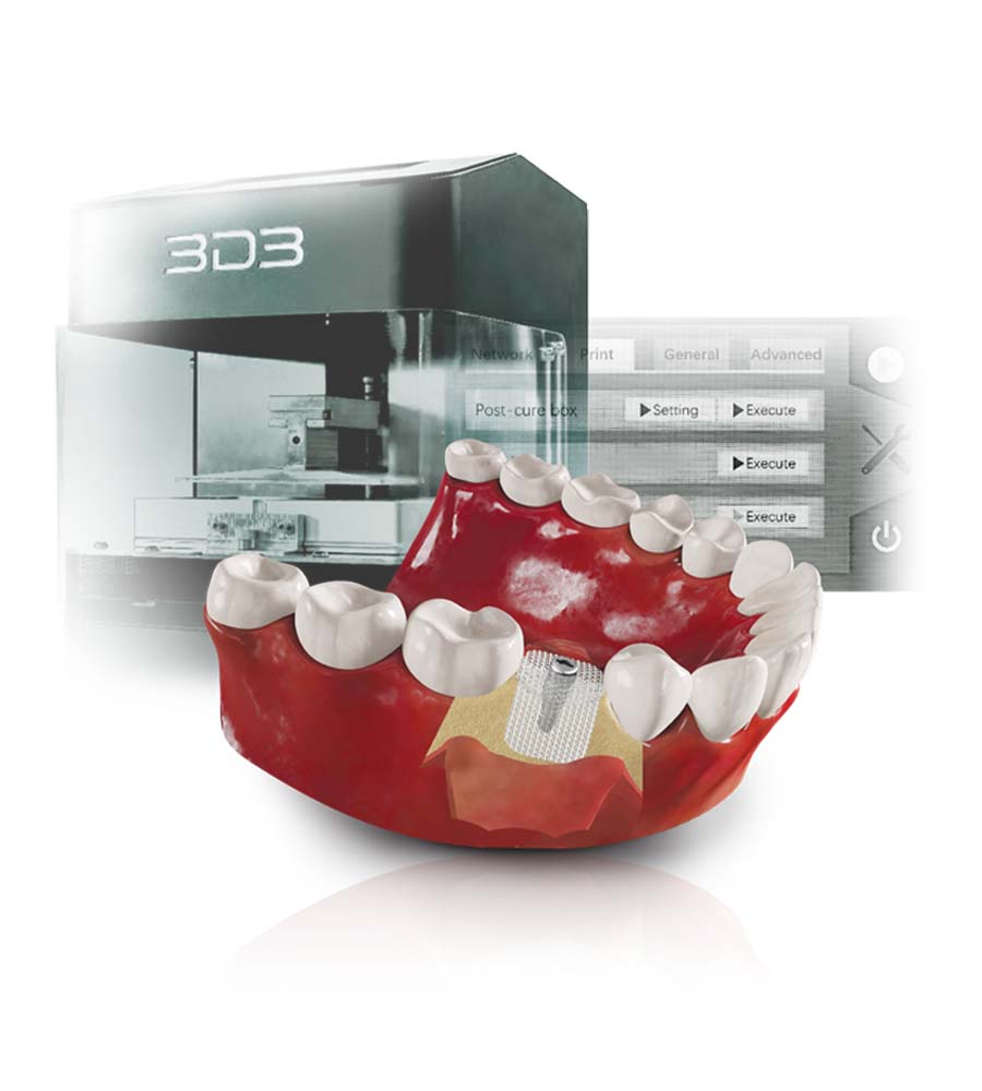 Digital Surgical Dentistry (DSD) System