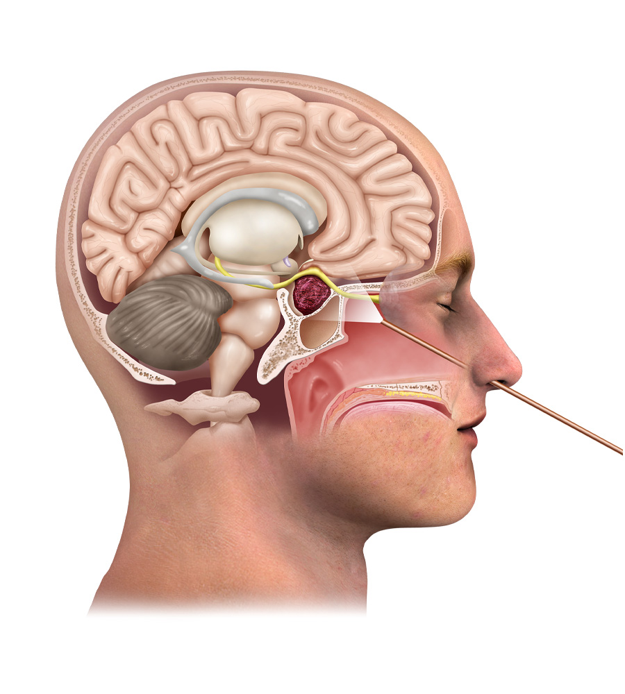 Minimally Invasive Skull Base Surgery